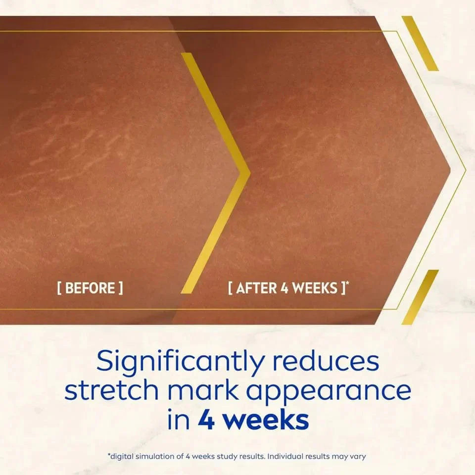 Nivea Luminous 630 Anti-Stretch Mark Body Oil Serum 100ml / 3.4 fl oz