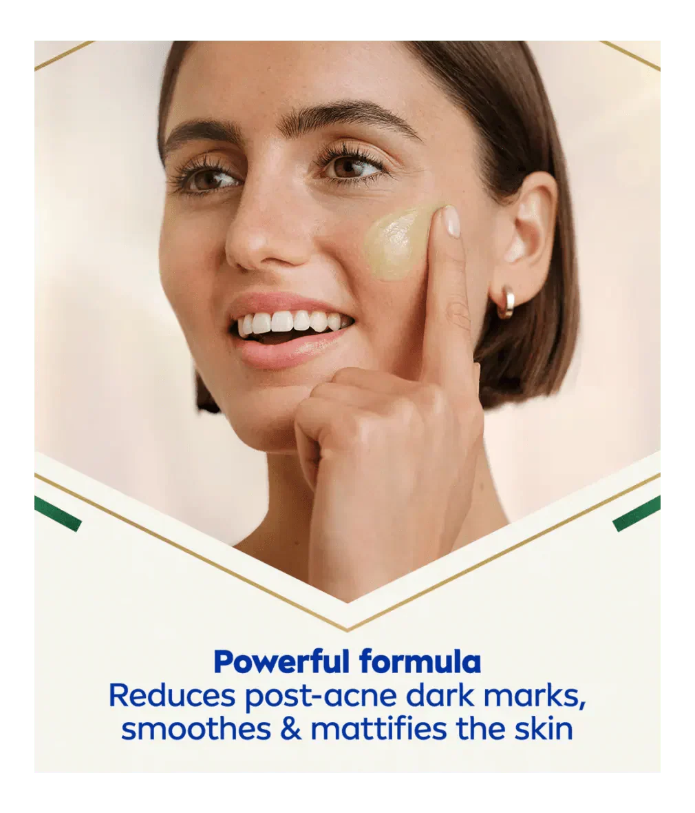 Nivea Luminous 630 Post-Acne Mark Skin Perfecting Serum 30ml / 1 fl.oz