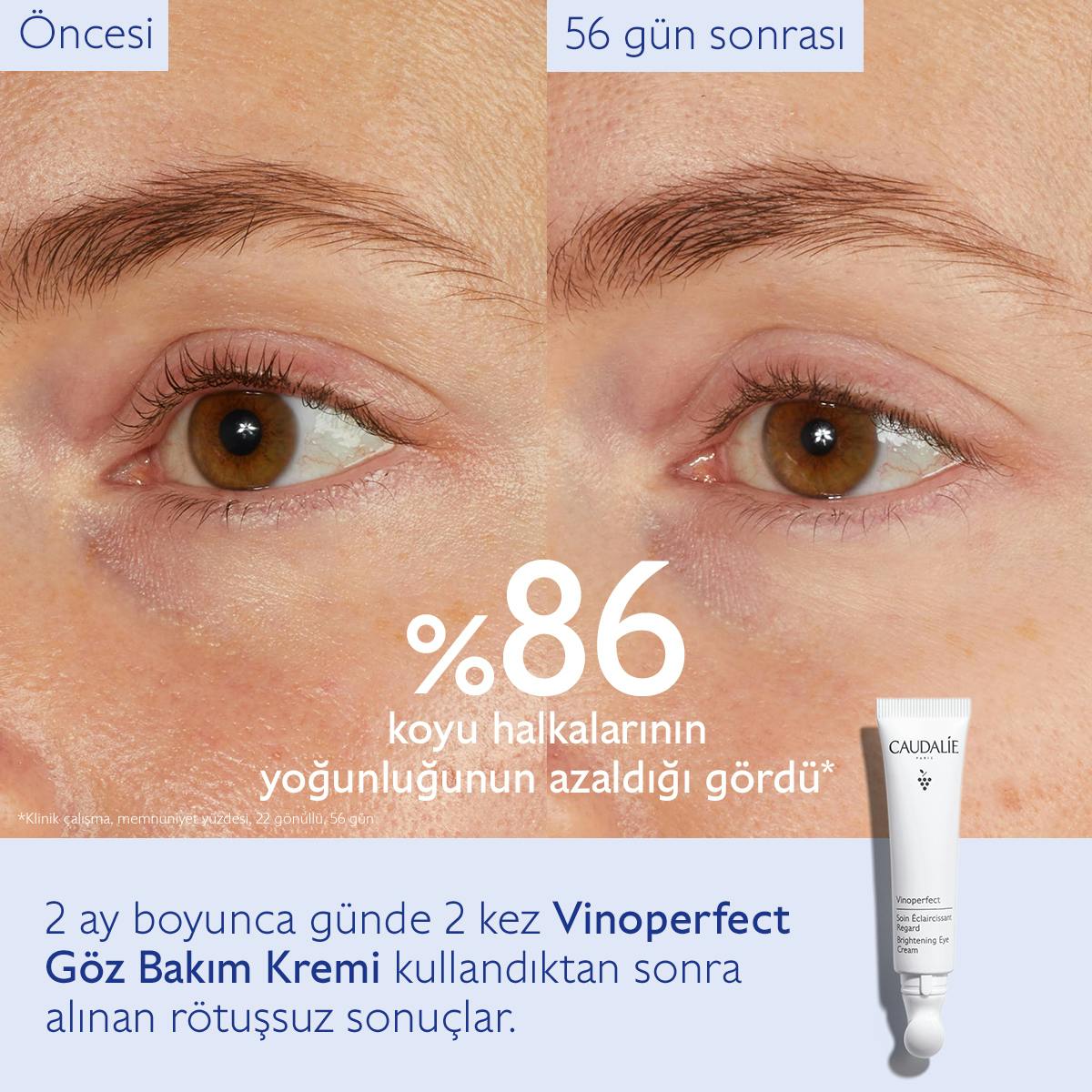 Caudalie Vinoperfect Işıltı Verici Göz Bakım Kremi 15 ml - Melori