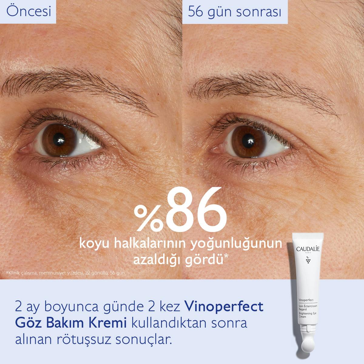 Caudalie Vinoperfect Işıltı Verici Göz Bakım Kremi 15 ml - Melori