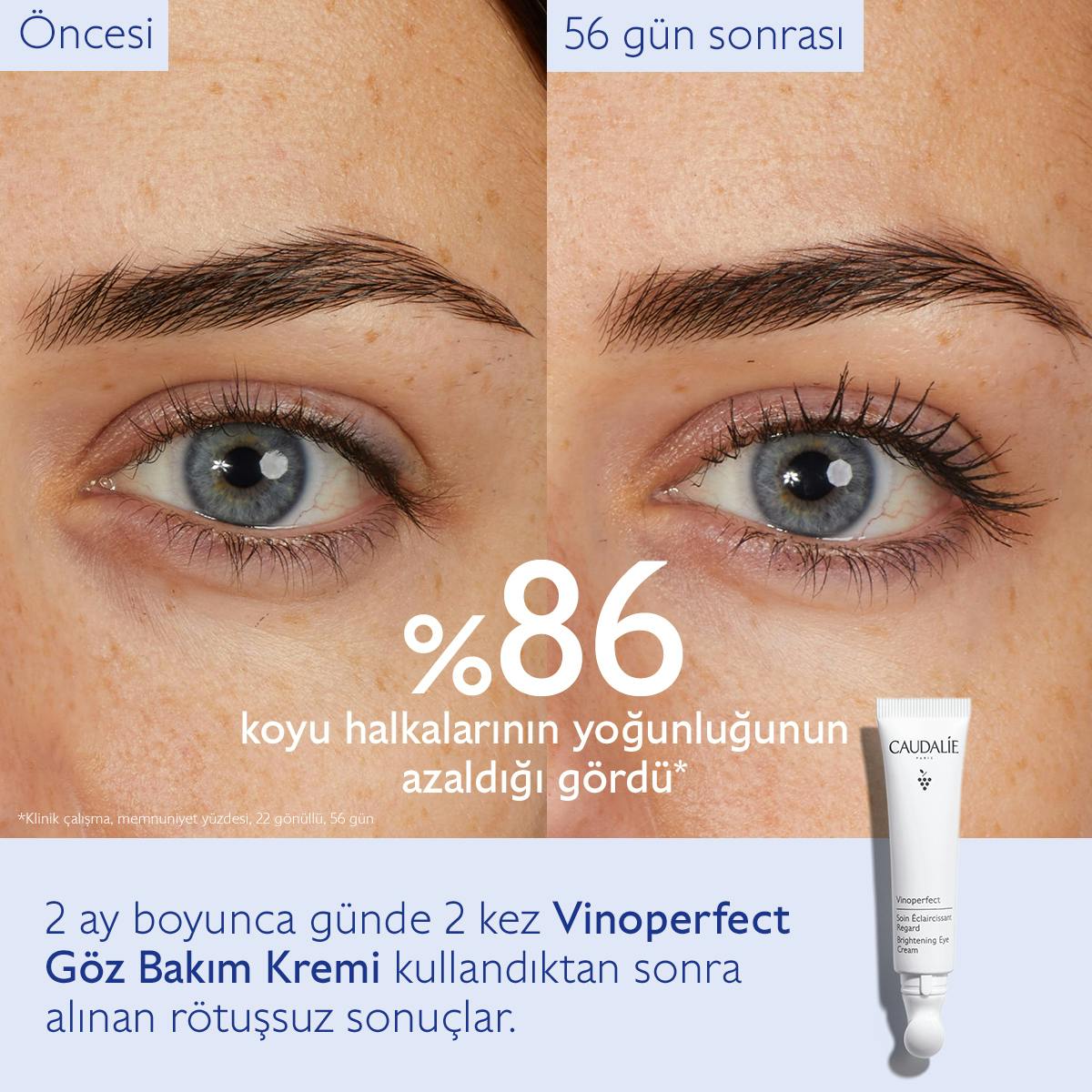 Caudalie Vinoperfect Işıltı Verici Göz Bakım Kremi 15 ml - Melori