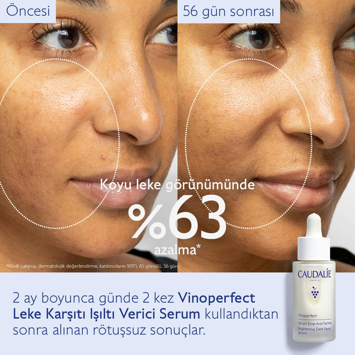 Caudalie Vinoperfect Leke Karşıtı ve Işıltı Verici Serum 30 ml - Melori