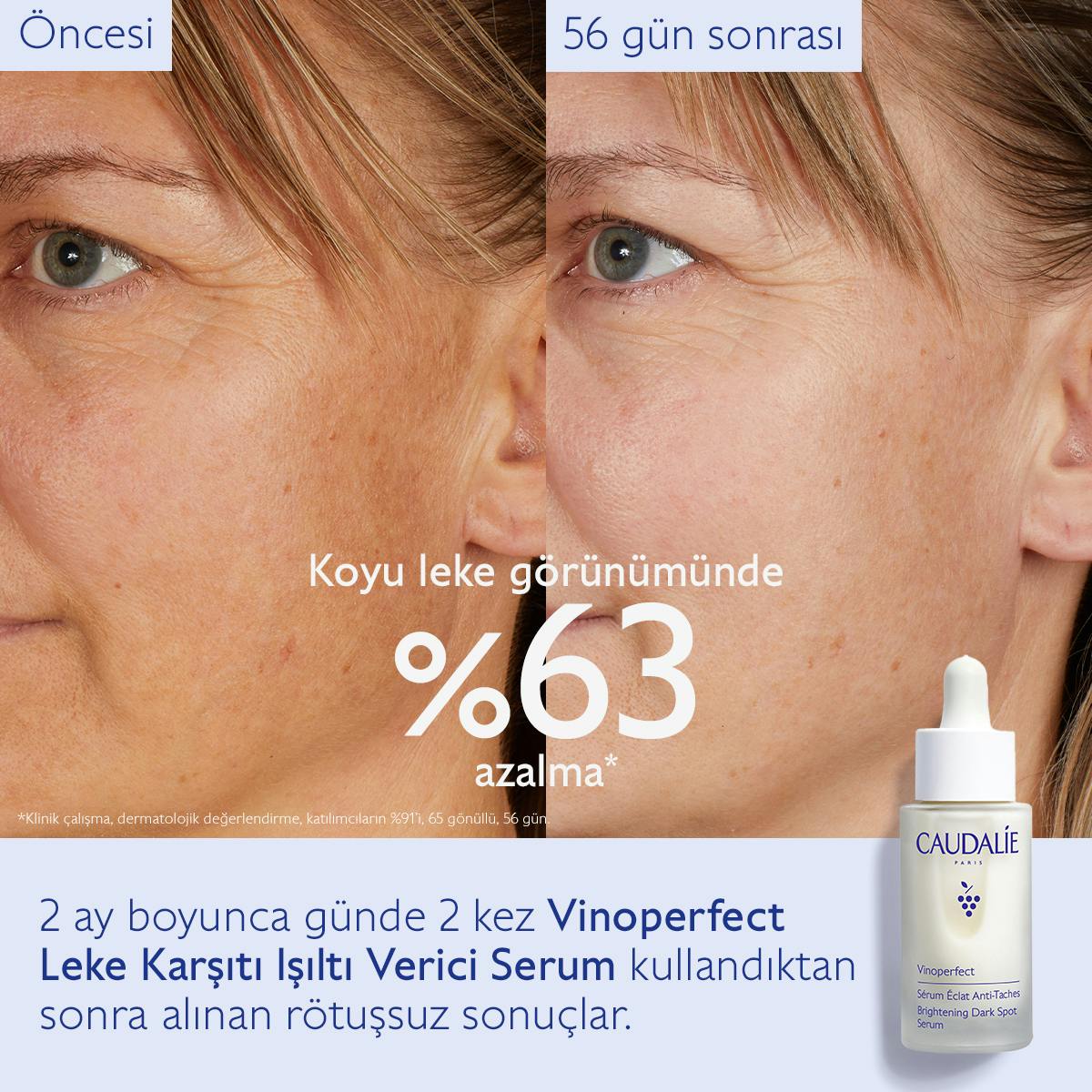 Caudalie Vinoperfect Leke Karşıtı ve Işıltı Verici Serum 30 ml - Melori