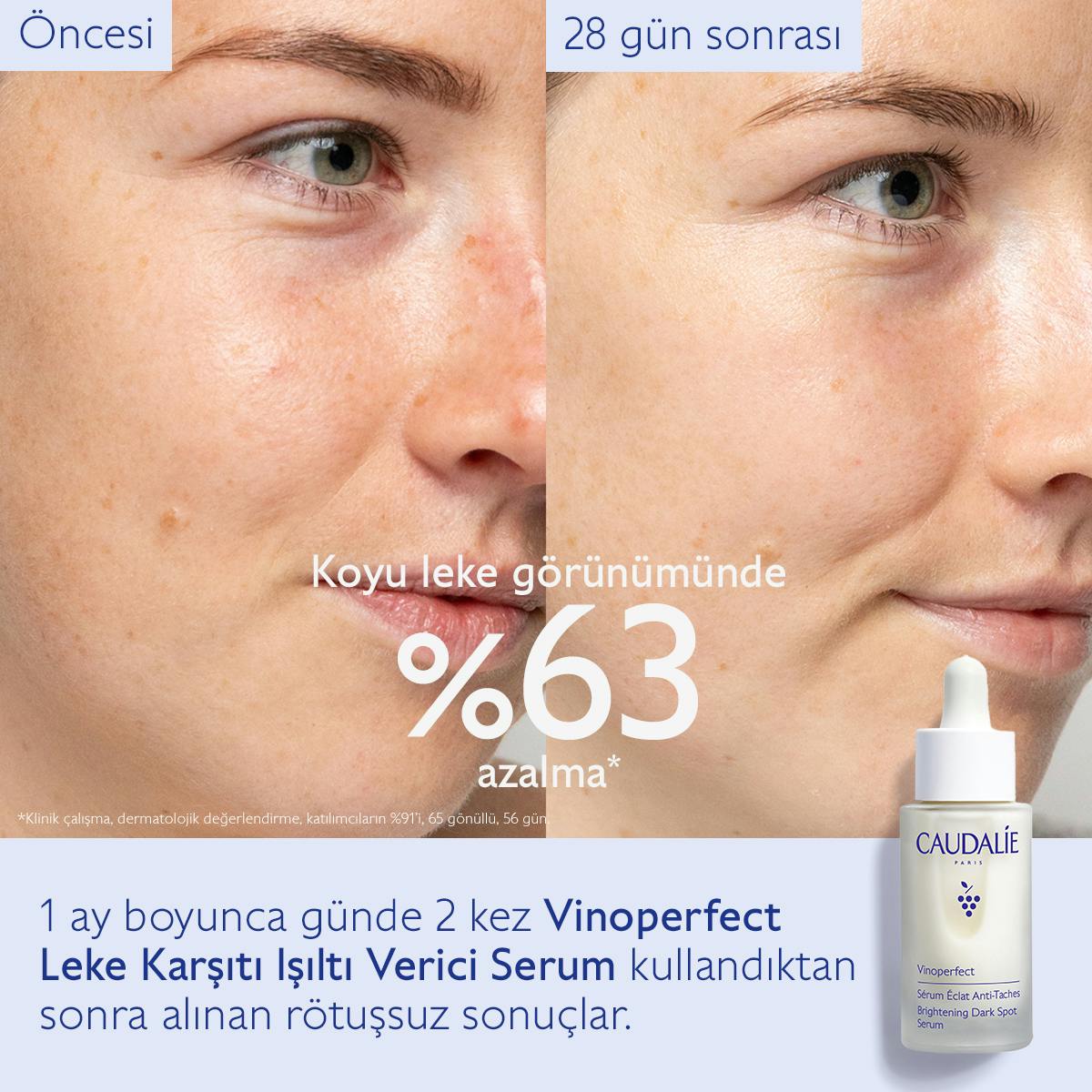 Caudalie Vinoperfect Leke Karşıtı ve Işıltı Verici Serum 30 ml - Melori