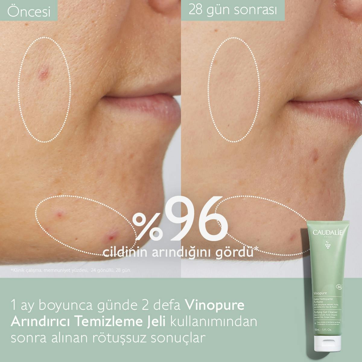 Caudalie Vinopure Arındırıcı Temizleme Jeli 150 ml - Melori