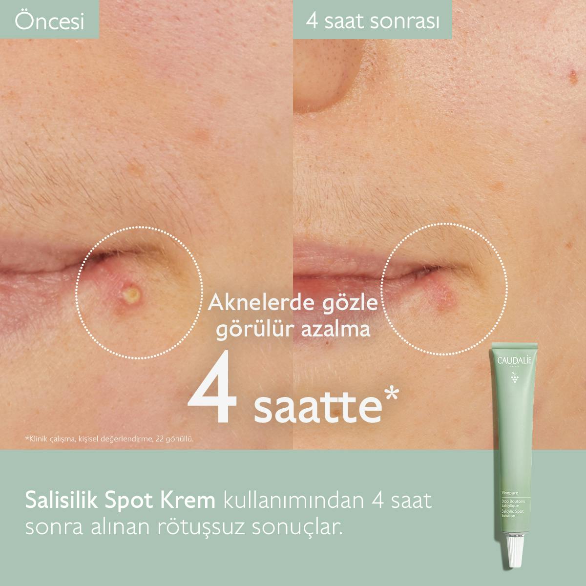 Caudalie Vinopure Düzensiz Ciltler İçin Salisilik Krem 15 ml - Melori