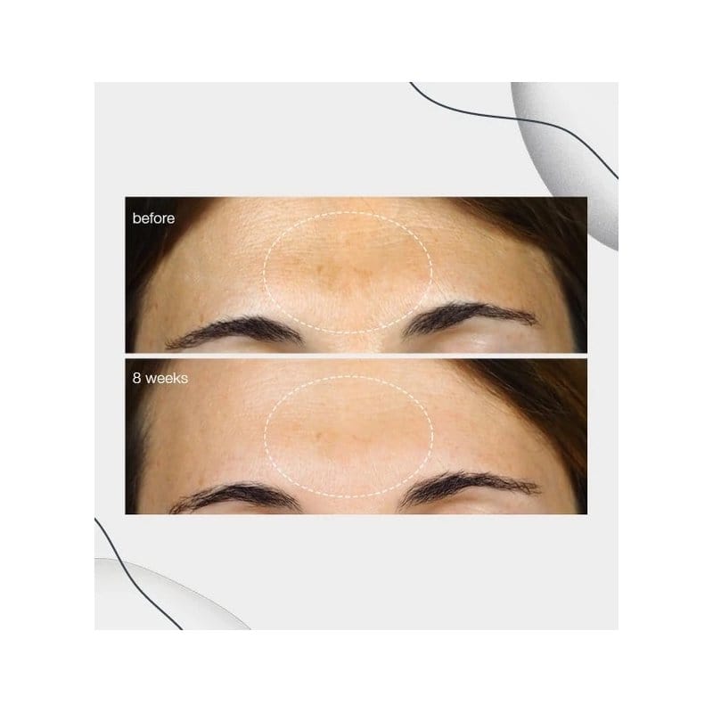 Dermalogica PowerBright Koyu Lekeler İçin Bakım Serumu 30 ml - Melori