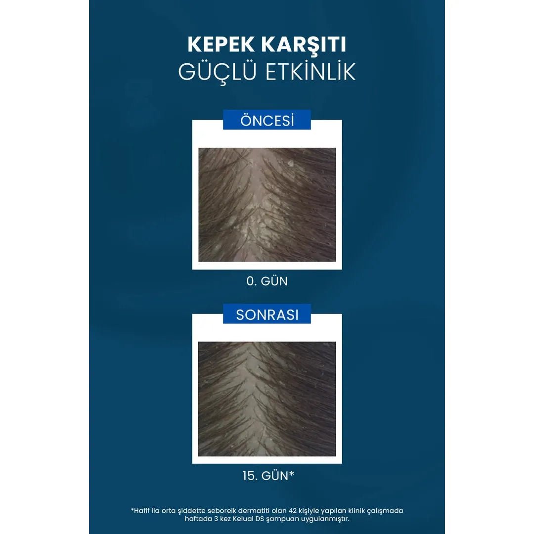 Ducray Kelual DS Shampoo Kepek Karşıtı Şampuan 100 ml - Melori