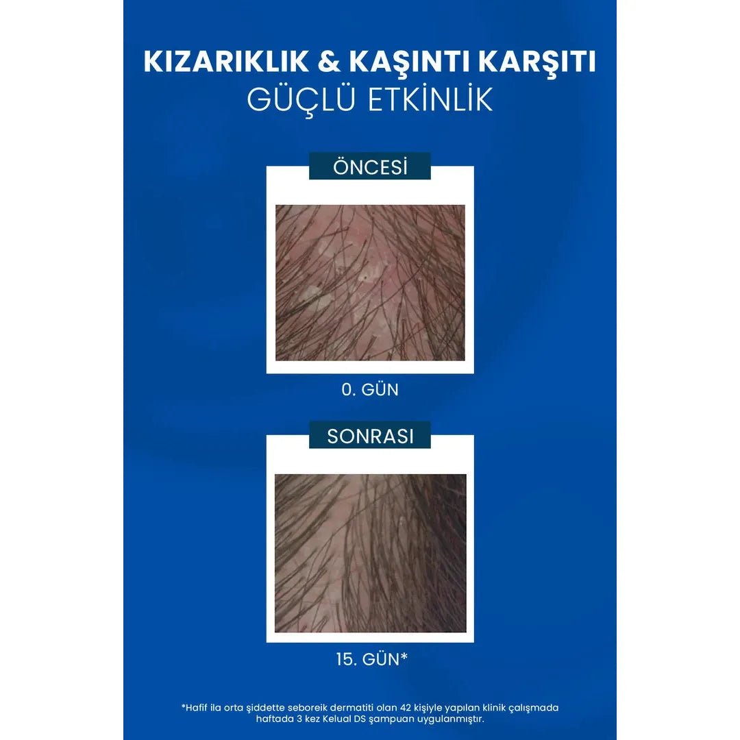 Ducray Kelual DS Shampoo Kepek Karşıtı Şampuan 100 ml - Melori