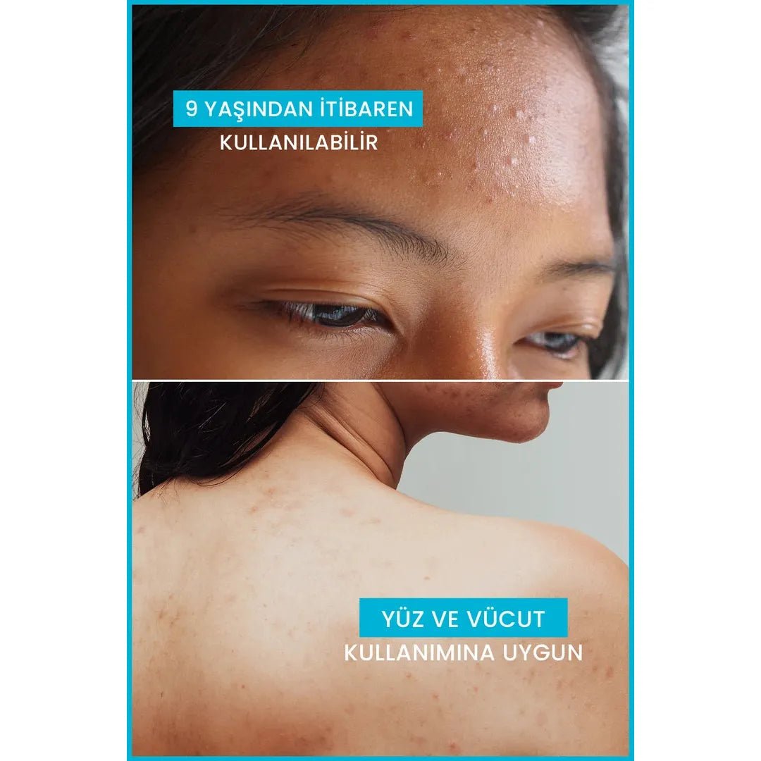 Ducray Keracnyl Akne Karşıtı Yüz Temizleme Jeli 400 ml - Melori