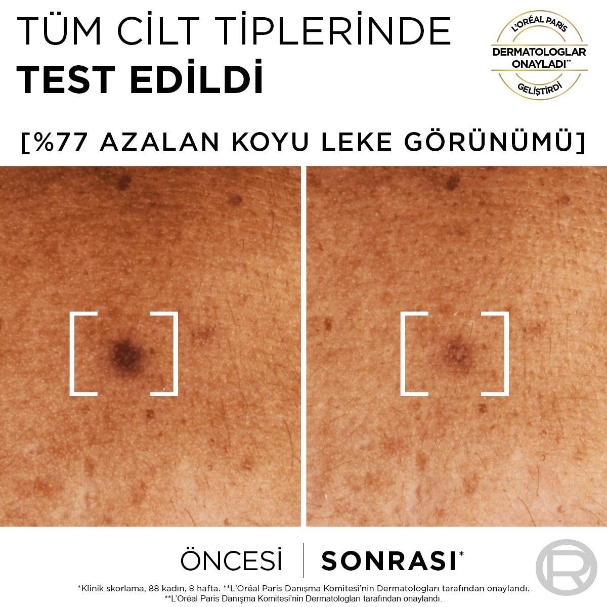 Loreal Paris Bright Reveal Sivilce, Güneş, Yaşlanma Lekelerinde Etkili Koyu Leke Karşıtı Serum 10%Niasinamid 30ml - Melori