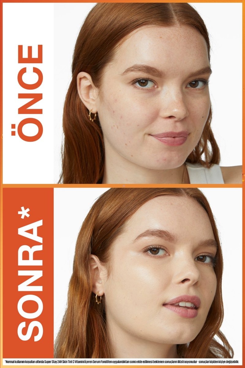 Maybelline Super Stay Skin Tint Fondöten - 40 - Melori