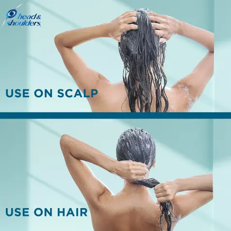 Head &amp; Shoulders Dermaxpro Moisturizing Hair and Scalp Conditioner 220ml