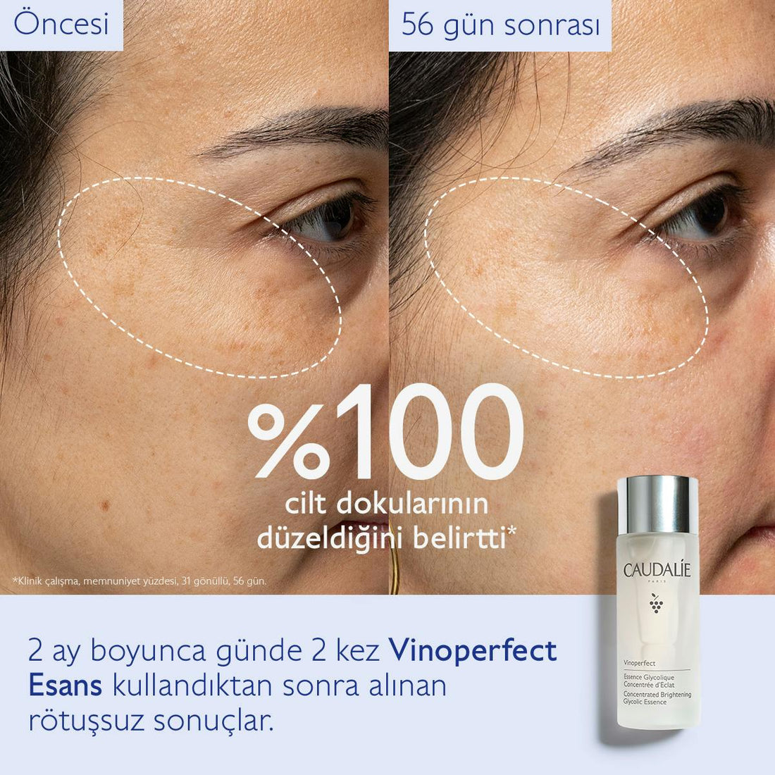 Caudalie Vinoperfect Leke Karşıtı ve Işıltı Verici Glikolik Esans 100 ml - Melori