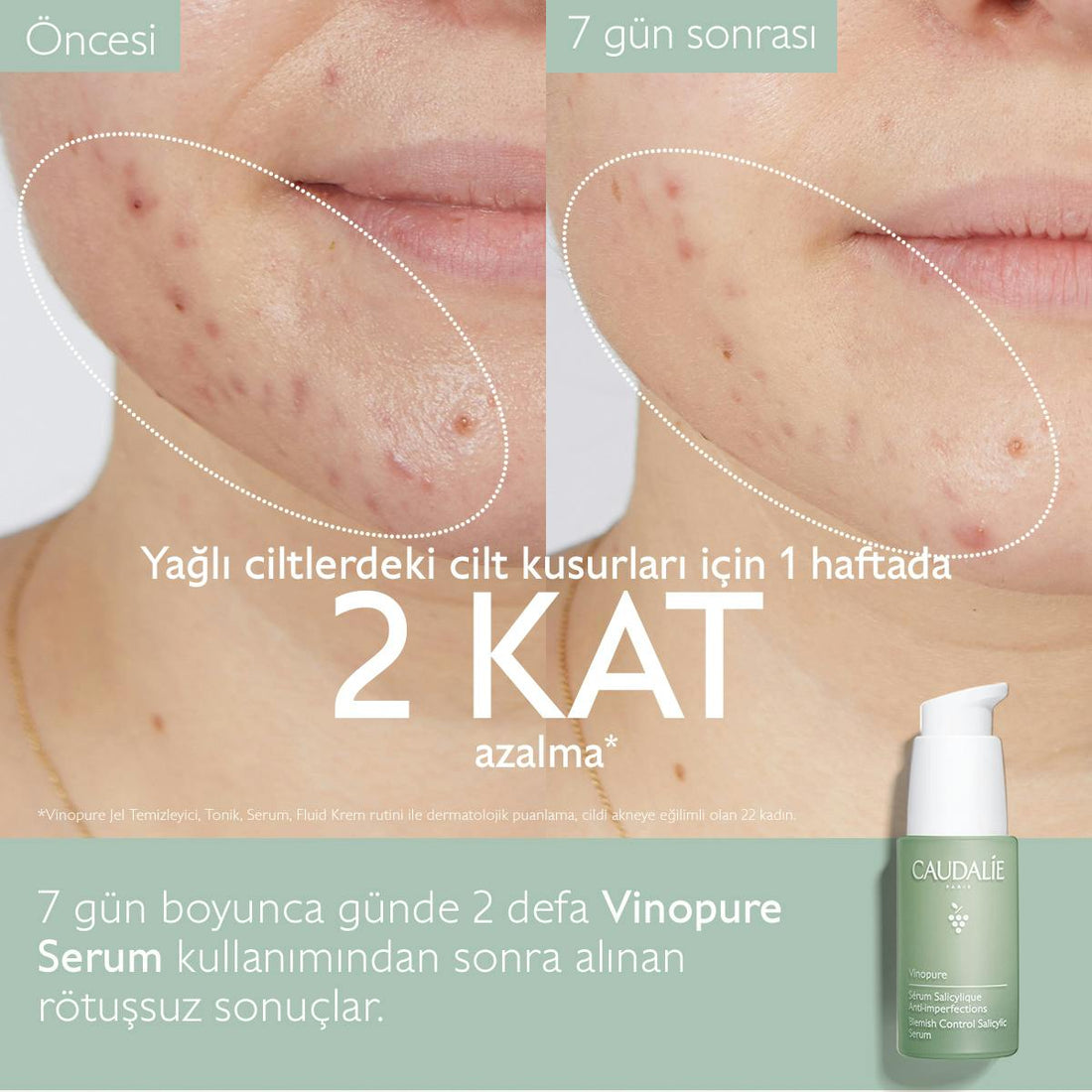 Caudalie Vinopure Blemish Control Salicylic Serum 30 ml - Melori