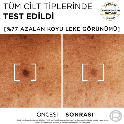 Loreal Paris Bright Reveal Sivilce, Güneş, Yaşlanma Lekelerinde Etkili Koyu Leke Karşıtı Serum 10%Niasinamid 30ml - Melori