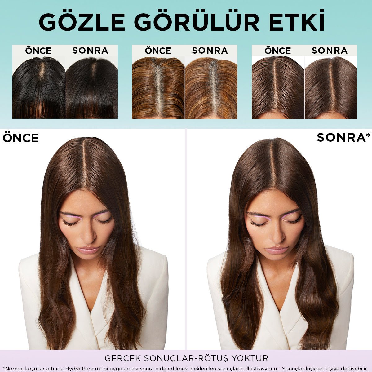 Loreal Paris Elseve Hydra [Hyaluronic] Pure Salisilik Asit içeren Yağlanma Karşıtı Nemlendirici Saç Kremi 250ml - Melori